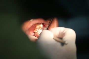 The Hidden Health Dangers Lurking in Your Mouth